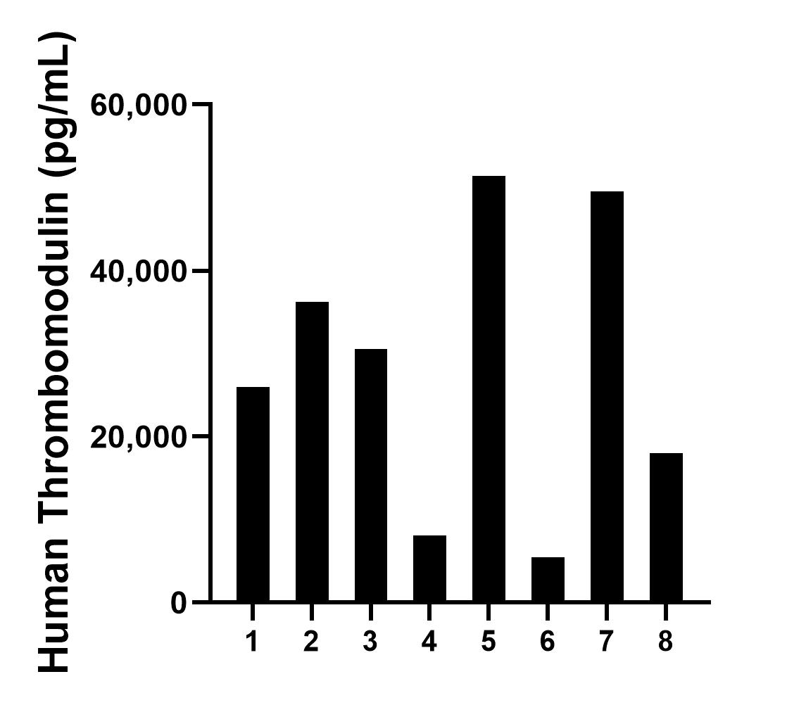 Urine of eight individual healthy human donors was measured. The CD141/Thrombomodulin concentration of detected samples was determined to be 28,157.6 pg/mL with a range of 5,473.9 - 51,428.0 pg/mL.
